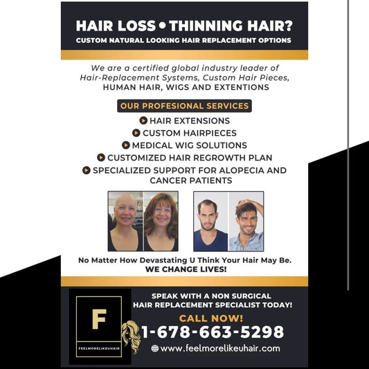 Can you never grow hair? (congenital atrichia) Discuss your options. We Change Lives! Let us help