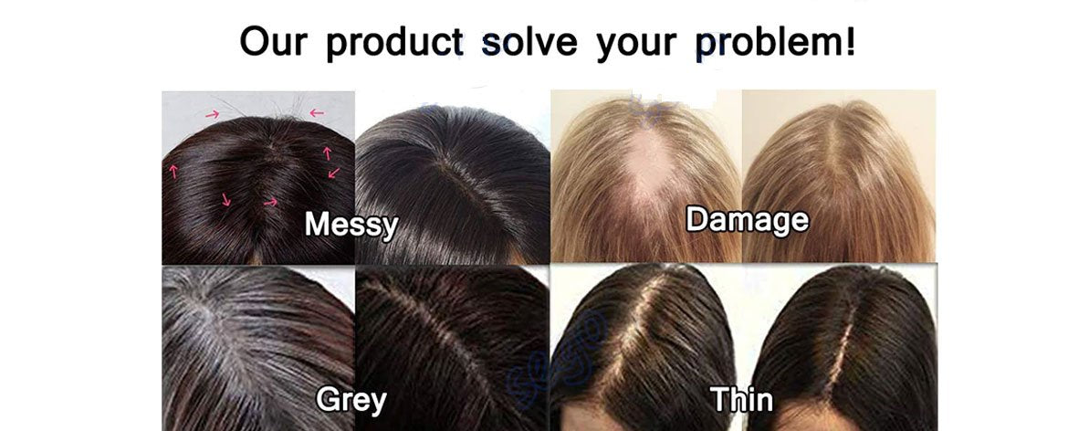 Women's Hair System