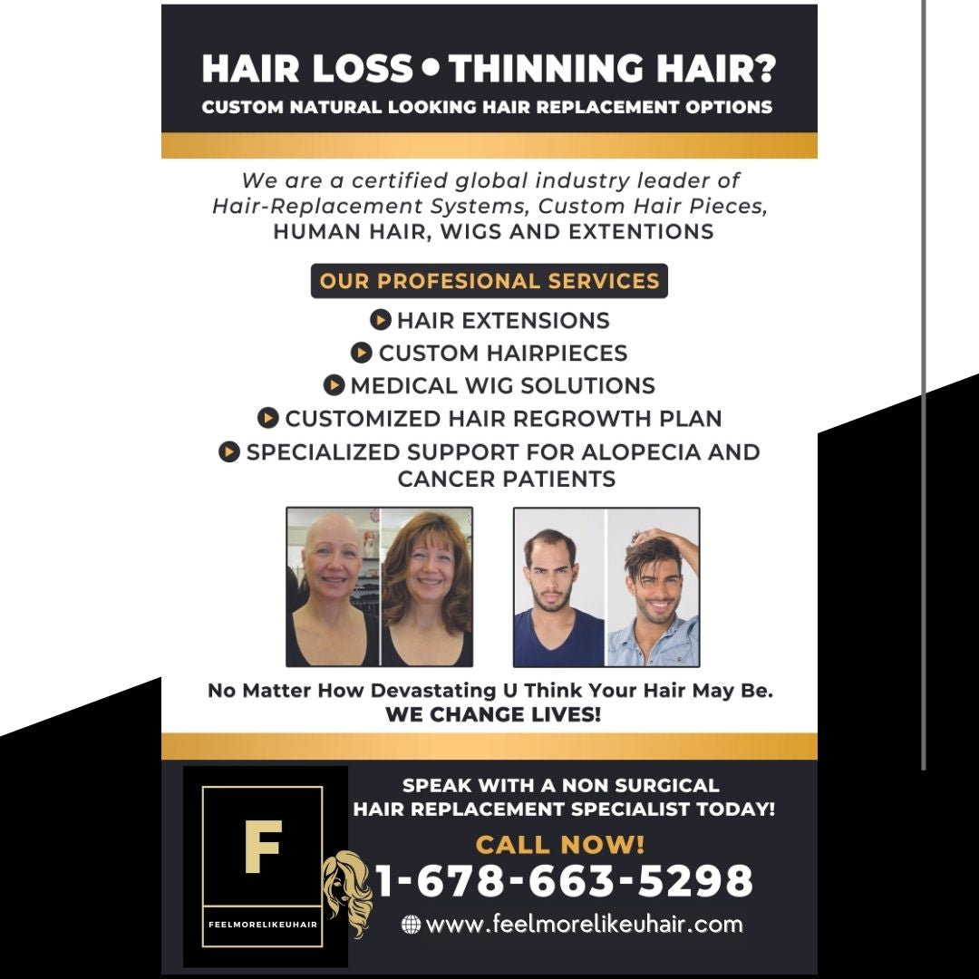 Can you never grow hair? (congenital atrichia) Discuss your options. We Change Lives! Let us help