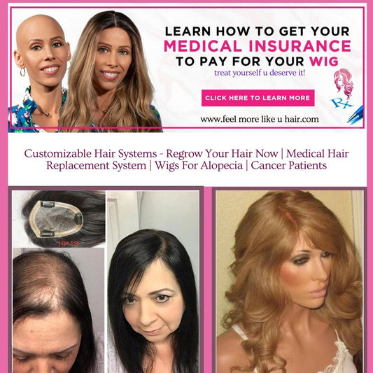 Customizable Hair Systems - Regrow Your Hair Now | Medical Hair Replacement System | Wigs For Alopecia | Cancer Patients