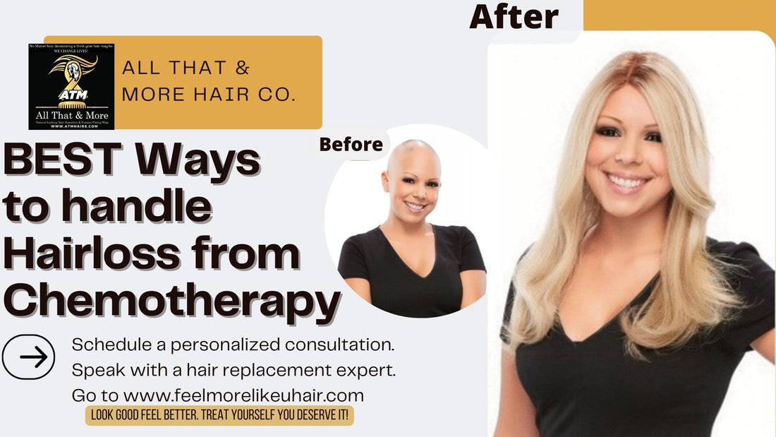 Is your HAIR LOSS making you look and feel older than you are? Has it caused you a lack of confidence and low SELF ESTEEM? Let Us Help You