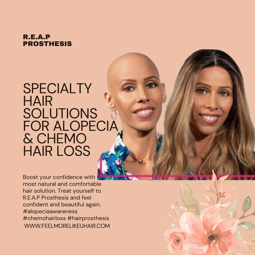 Insurance-Compatible Cranial Prosthesis | Use HCPCS Code S8095 for easy billing and reimbursement. Pair with the appropriate diagnosis code to ensure seamless coverage for hair loss due to medical conditions.

