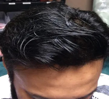 EZ Hair System | This is not a toupee! Synthetic & Human Hair Available