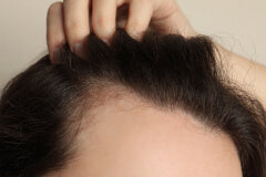 Unlock Your Hair's Potential: Hair Consultation & Scalp Evaluation + Hair Extension/Alternative Solutions Consultation (In-Person Showroom Visit)