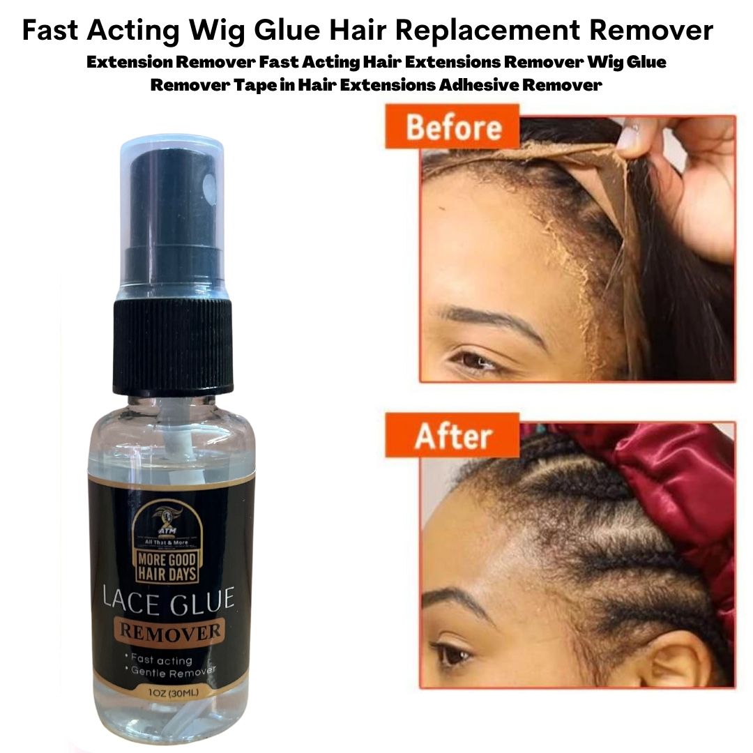 Medical Grade Fast Acting Adhesive Solvent Spray Remover for Lace Wigs & Toupees, Wig Tape Remover