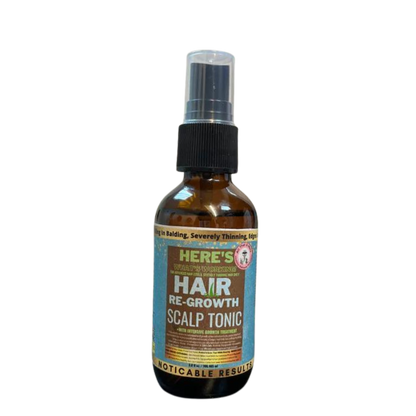 Finally MY EDGES ARE BACK. No More Hair Loss Here's What's Working! Best Hair Regrowth Scalp Treatment Tonic