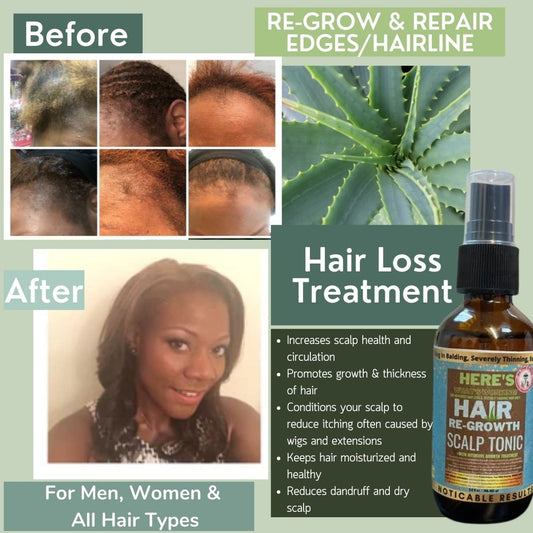 Finally MY EDGES ARE BACK. No More Hair Loss Here's What's Working! Best Hair Regrowth Scalp Treatment Tonic