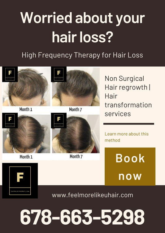 Worried about your hair loss? Hair regrowth - hair transformation services | Make An Appointment