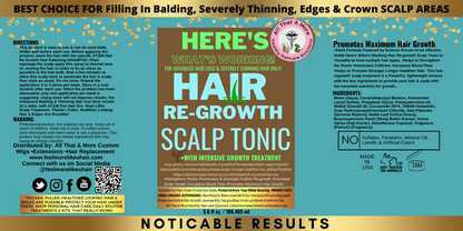Finally MY EDGES ARE BACK. No More Hair Loss Here's What's Working! Best Hair Regrowth Scalp Treatment Tonic
