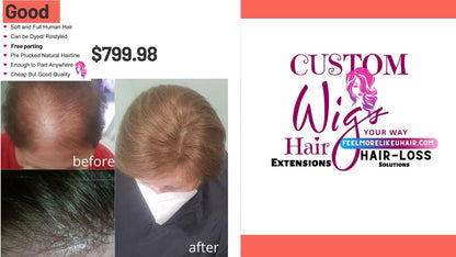 CUSTOM HAIR PIECE SYSTEM | Conceal thinning Hair Immediately | Natural Looking Custom Fitting Non-Surgical Hair Solutions