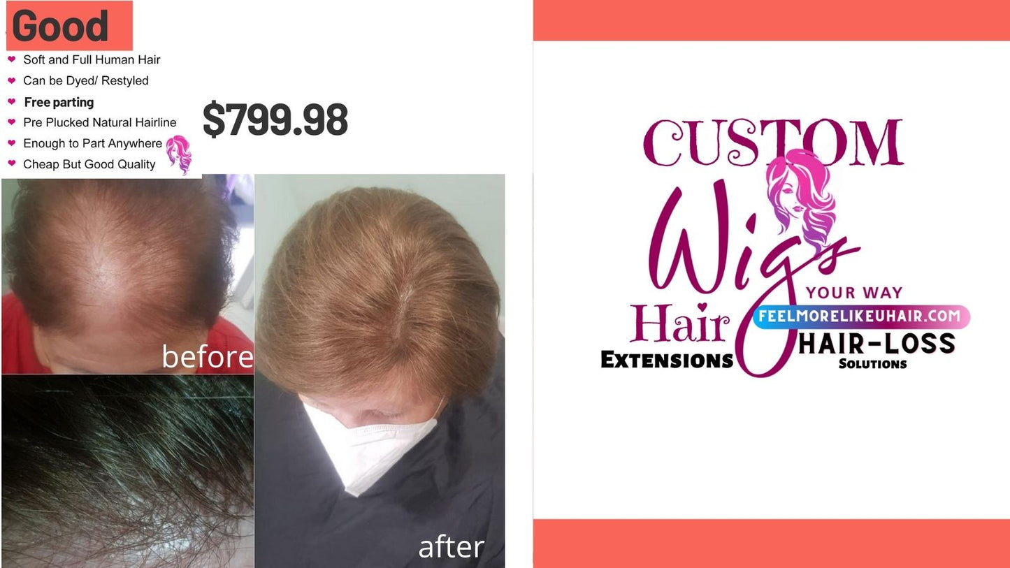 CUSTOM HAIR PIECE SYSTEM | Conceal thinning Hair Immediately | Natural Looking Custom Fitting Non-Surgical Hair Solutions