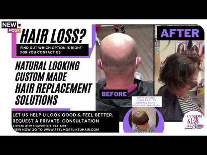 Hair Loss & Hair Replacement Solutions | Get A Private 1-on-1 Consultation