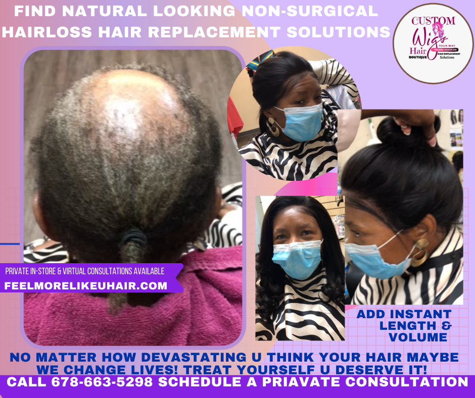 Custom Alopecia Hair Replacement Solutions