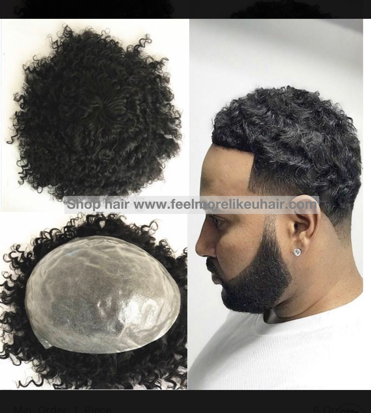Hair Loss & Hair Replacement Solutions | Get A Private 1-on-1 Consultation
