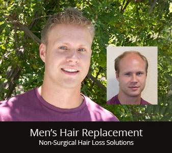 Hair Loss & Hair Replacement Solutions | Get A Private 1-on-1 Consultation