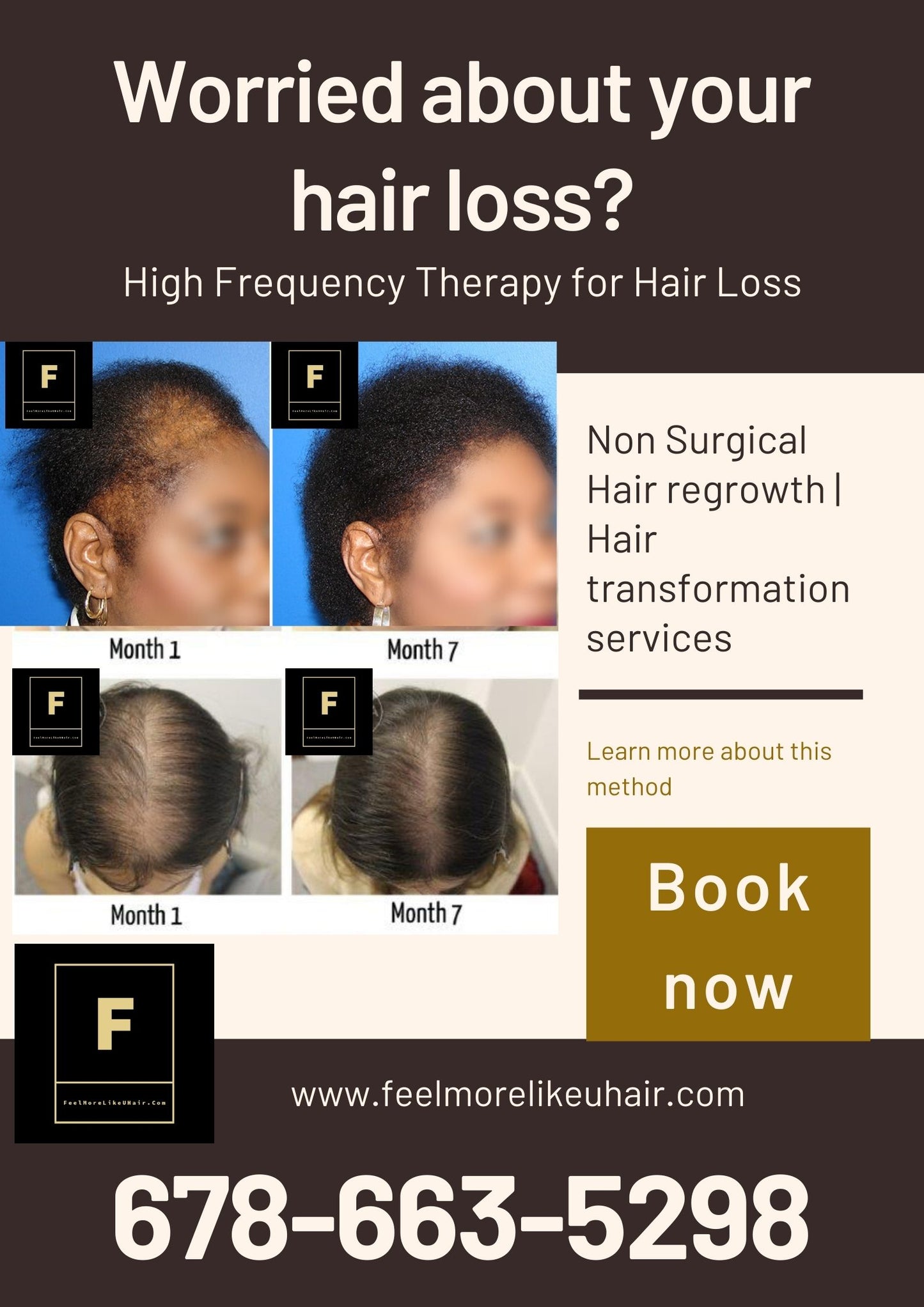 Worried about your hair loss? Hair regrowth - hair transformation services | Make An Appointment